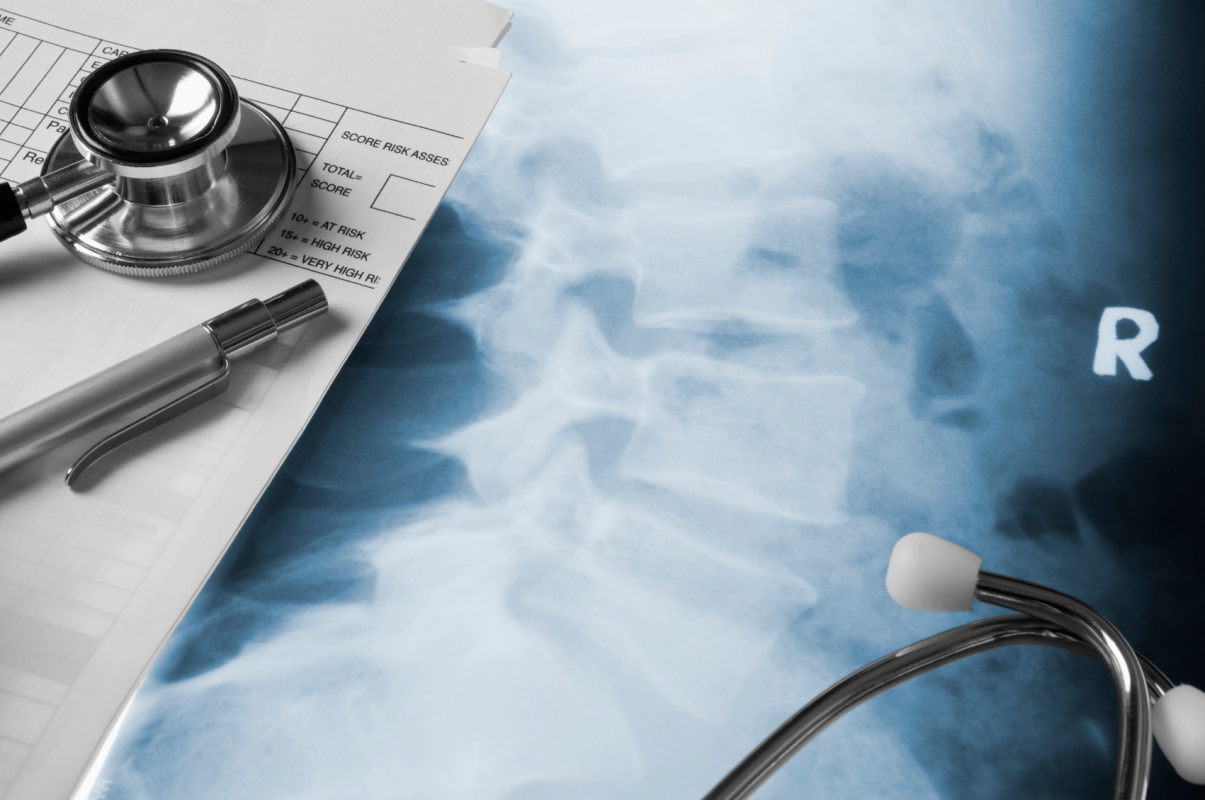 Radiology Image